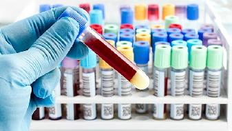 美国疫情确诊人数上升,全球新冠肺炎确诊超200万例